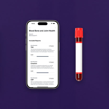 Zdraví Kostí a Kloubů Krevní test 