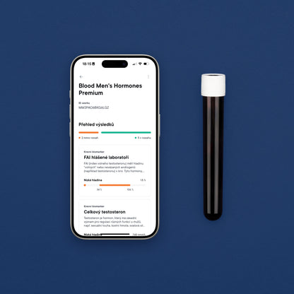 Mužské hormony Krevní test