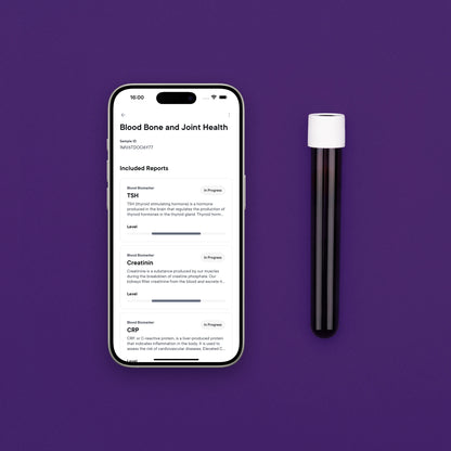 Zdraví Kostí a Kloubů Krevní test 